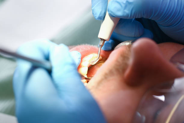 Trusted GA Emergency Dental Service Experts