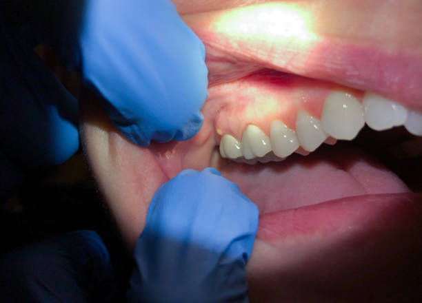 Best Urgent Dental Care for Toothaches in Moody Af, GA